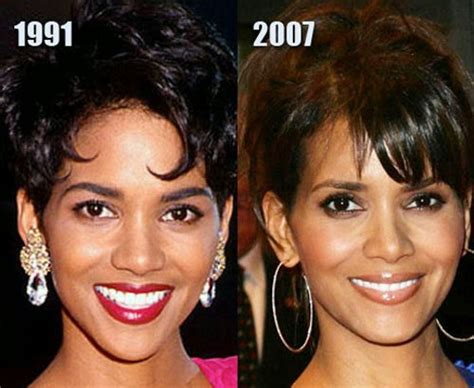 halle berry implants|Halle Berry: Before and After